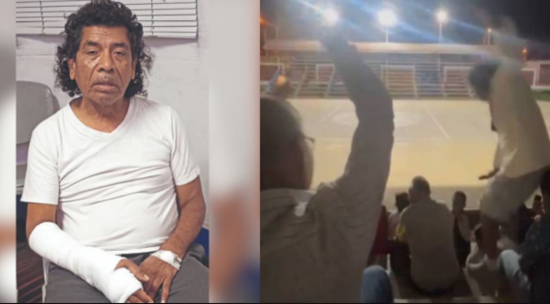 Cachay vendió su carpa de circo para operarse