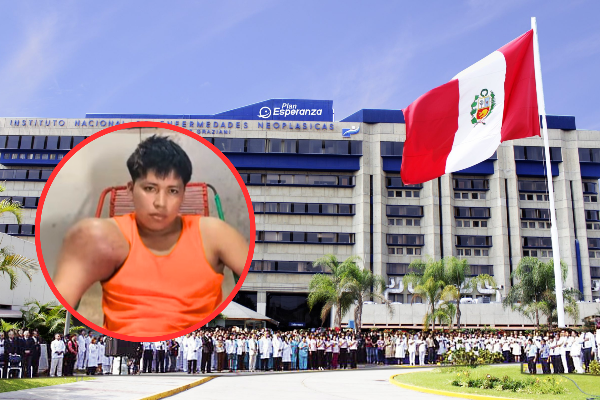Joven de Pucallpa presenta un gran tumor en el hombro y pide ayuda para viajar a Lima