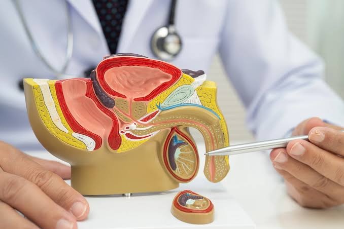 Iren centro detecto 597 casos de cancer de próstata desde 2020 y alerta por diagnósticos tardíos
