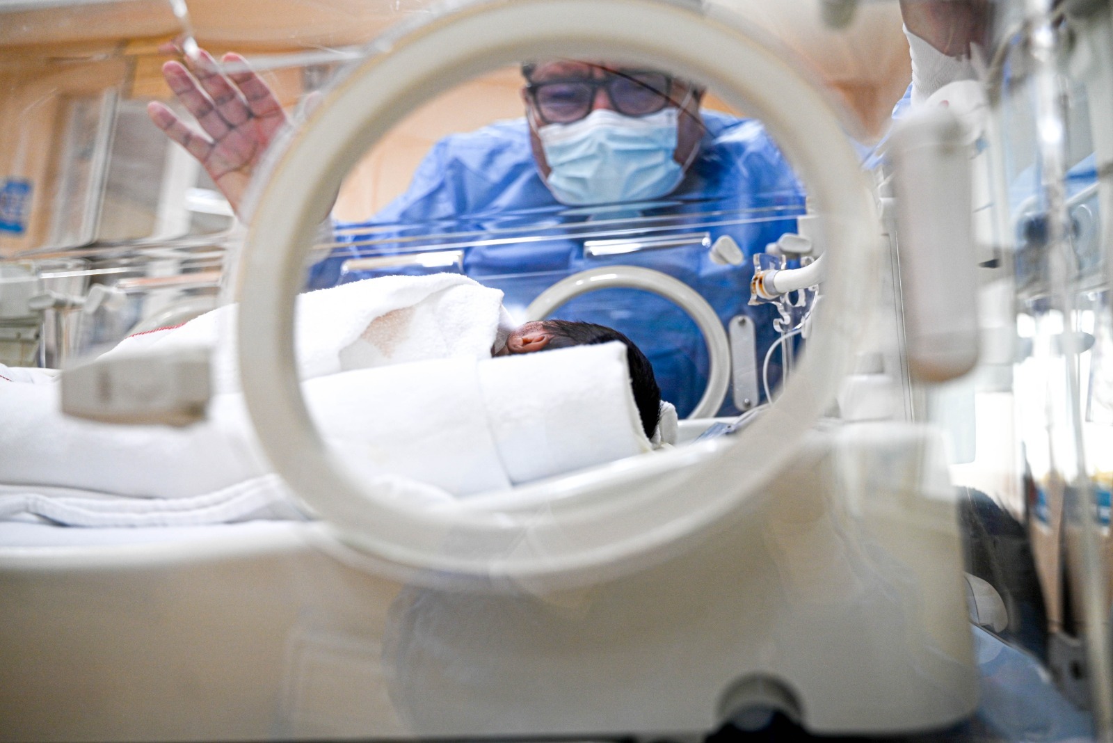 ¡Proeza médica! Especialistas del INSN Breña salvan a una bebé prematura de un kilo tras compleja cirugía para extraerle un catéter incrustado